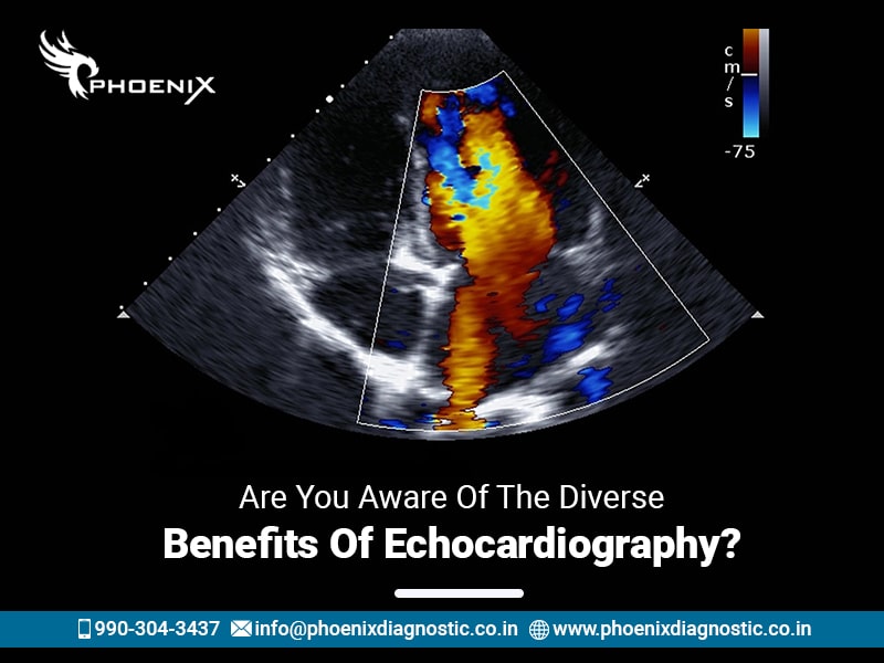 Are You Aware Of The Diverse Benefits Of Echocardiography?