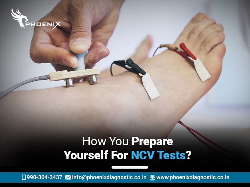 How You Prepare Yourself For NCV Tests?
