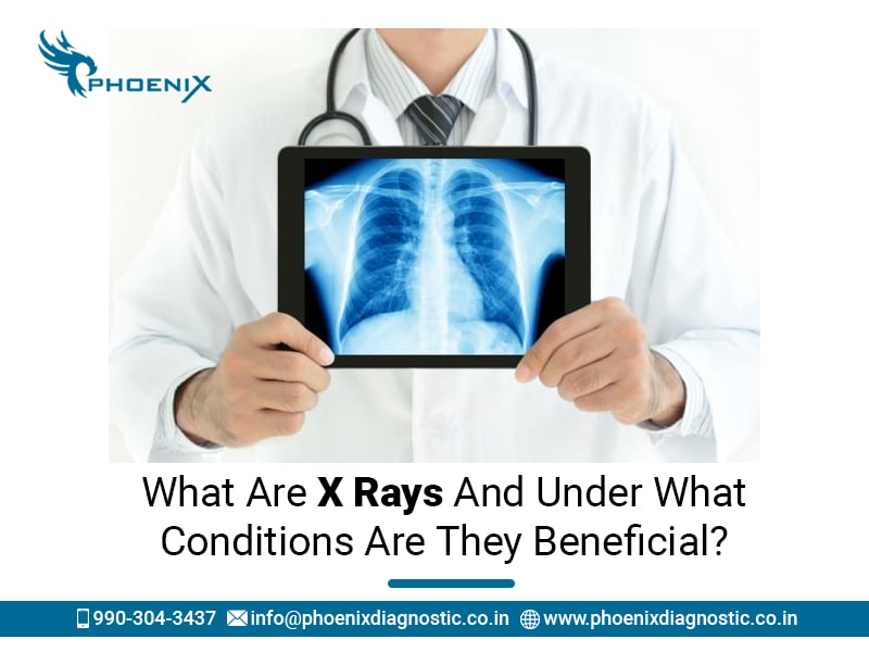 What Are X Rays and Under What Conditions Are They Beneficial?