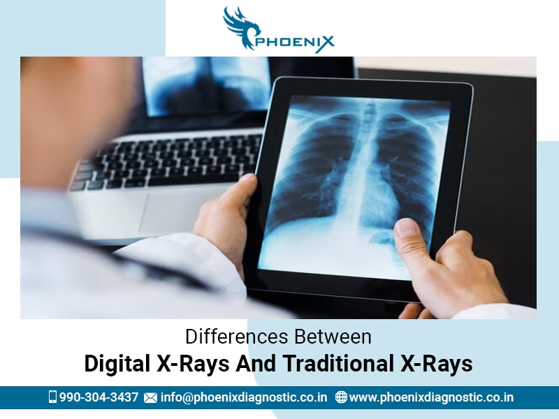 Differences Between Digital X-Rays And Traditional X-Rays