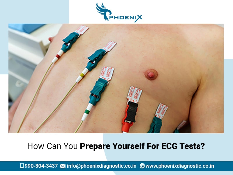 How Can You Prepare Yourself For ECG Tests?