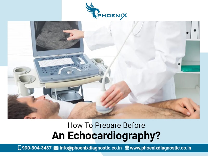 How To Prepare Before An Echocardiography?