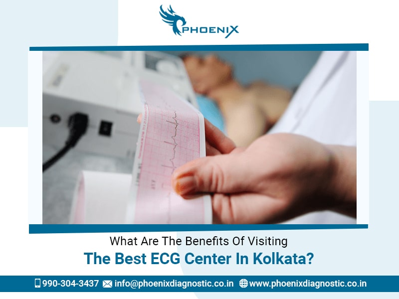 What Are The Benefits Of Visiting The Best ECG Center In Kolkata?