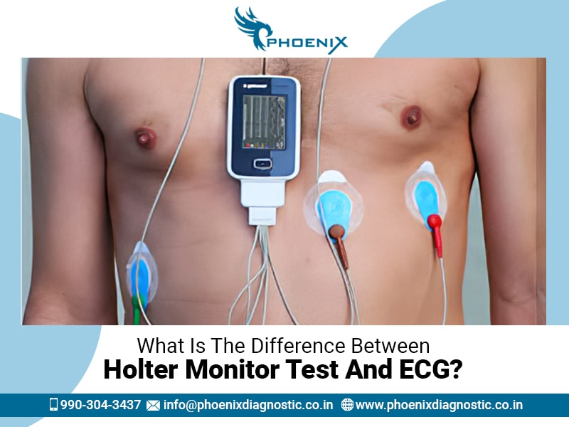 What Is The Difference Between Holter Monitor Test And ECG?